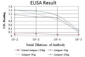 Red: Control Antigen (100 ng), Purple: Antigen (10 ng), Green: Antigen (50 ng), Blue: Antigen (100 ng), (IRAK4 抗体)