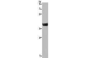 Western Blotting (WB) image for anti-Hydroxysteroid (17-Beta) Dehydrogenase 2 (HSD17B2) antibody (ABIN2423607) (HSD17B2 抗体)