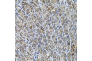 Immunohistochemistry of paraffin-embedded mouse stomach using UBE2A antibody. (UBE2A 抗体)