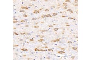 Immunohistochemistry analysis of paraffin-embedded mouse brain using,KCNG3 (ABIN7075157) at dilution of 1: 2000 (KCNG3 抗体)