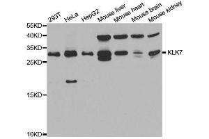 Western blot analysis of extracts of various cell lines, using KLK7 antibody. (Kallikrein 7 抗体  (AA 30-253))