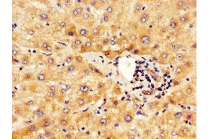 IHC image of ABIN7156203 diluted at 1:500 and staining in paraffin-embedded human liver tissue performed on a Leica BondTM system.