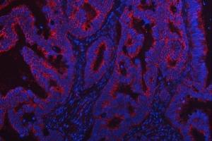 IF analysis of TRMT2B using anti-TRMT2B antibody (ABIN7599456).