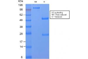 SDS-PAGE Analysis Purified CD59 Rabbit Recombinant Monoclonal Antibody (MACIF/2867R). (Recombinant CD59 抗体)