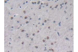 Detection of IL2 in Mouse Cerebrum Tissue using Polyclonal Antibody to Interleukin 2 (IL2) (IL-2 抗体  (AA 10-169))