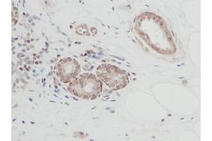 Image no. 1 for anti-Cardiotrophin 1 (CTF1) antibody (ABIN465487) (Cardiotrophin 1 抗体)
