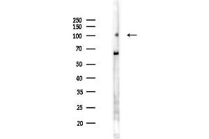 anti-Schlafen Family Member 5 (SLFN5) antibody
