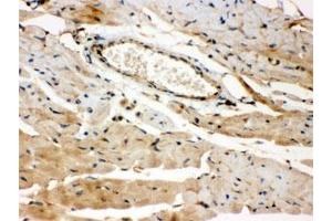 IHC testing of FFPE mouse heart with ROCK2 antibody. (ROCK2 抗体  (AA 652-923))