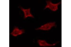 ABIN6275935 staining Hela by IF/ICC. (LPAR3 抗体  (Internal Region))