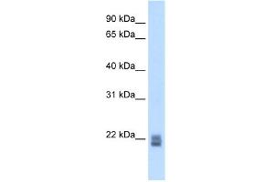 WB Suggested Anti-Rgs1 Antibody Titration:  5. (RGS1 抗体  (N-Term))