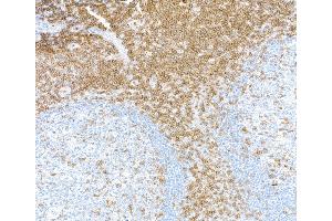 Immunohistochemistry (IHC) image for anti-CD3 epsilon (CD3E) (AA 139-189) antibody (ABIN7454000)