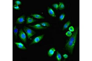 Immunofluorescent analysis of A549 cells using ABIN7151925 at dilution of 1:100 and Alexa Fluor 488-congugated AffiniPure Goat Anti-Rabbit IgG(H+L) (EMP1 抗体  (AA 22-66))