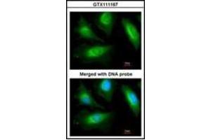 Immunofluorescence analysis of paraformaldehyde-fixed HeLa, using actinin, alpha 2 antibody at 1/200 dilution. (ACTN2 抗体)