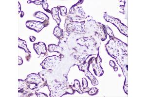 IHC analysis of cortactin using anti-cortactin antibody (ABIN6719306). (Cortactin 抗体  (AA 1-105))