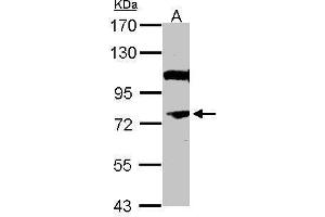 Western Blotting (WB) image for anti-Nuclear Receptor Subfamily 4, Group A, Member 3 (NR4A3) (N-Term) antibody (ABIN2854991)