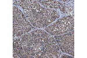 IHC analysis of XRCC4 using anti-XRCC4 antibody (ABIN7599168).