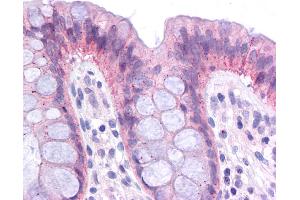 Immunohistochemistry (IHC) image for anti-CCAAT/enhancer Binding Protein (C/EBP), alpha (CEBPA) (Middle Region) antibody (ABIN504380) (CEBPA 抗体  (Middle Region))