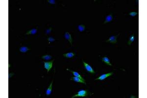 Immunofluorescent analysis of U251 cells using ABIN7159955 at dilution of 1:100 and Alexa Fluor 488-congugated AffiniPure Goat Anti-Rabbit IgG(H+L) (UCP3 抗体  (AA 33-76))