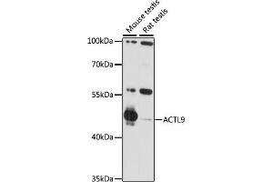 Western blot analysis of extracts of various cell lines, using  antibody (ABIN7265389) at 1:1000 dilution. (ACTL9 抗体  (AA 1-416))