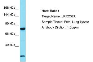 Host: Rabbit Target Name: LRRC37A2 Sample Tissue: Human Fetal Lung Antibody Dilution: 1ug/ml (LRRC37A 抗体  (C-Term))