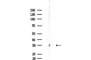 Western blot analysis of lysates from MCF7 cells(heat-shock,45 min treatment), using Phospho-CDK1/CDC2 (Tyr15) Antibody at 1/1000 dilution.