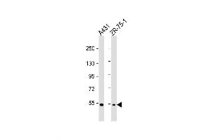 Western Blot at 1:1000 dilution Lane 1: A431 whole cell lysate Lane 2: ZR-75-1 whole cell lysate Lysates/proteins at 20 ug per lane. (MEFV 抗体  (AA 418-445))