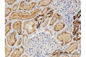 Immunostaining (ISt) image for anti-Angiotensinogen (serpin Peptidase Inhibitor, Clade A, Member 8) (AGT) (AA 1-485) antibody (ABIN513185)