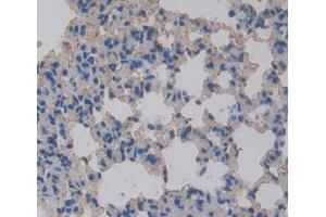 Used in DAB staining on fromalin fixed paraffin- embedded lung tissue (ALOX12B 抗体  (AA 389-701))