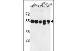 Western blot analysis of M1H Antibody (Center) (ABIN653037 and ABIN2842651) in K562, 293, MCF-7, Jurkat cell line and mouse spleen tissue lysates (35 μg/lane). (PPM1H 抗体  (AA 235-263))