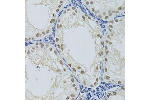 Immunohistochemistry of paraffin-embedded rat testis using DDB1 Antibody. (DDB1 抗体)