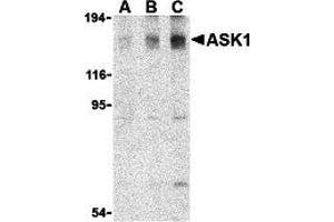 Western Blotting (WB) image for anti-Mitogen-Activated Protein Kinase Kinase Kinase 5 (MAP3K5) antibody (ABIN1030199) (ASK1 抗体)