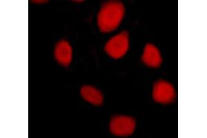ABIN6269102 staining MCF-7 cells by ICC/IF. (Progesterone Receptor 抗体)
