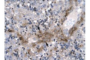 ZNF365 antibody was used for immunohistochemistry at a concentration of 4-8 ug/ml to stain Hepatocyte (arrows) in Human Liver. (ZNF365 抗体  (N-Term))