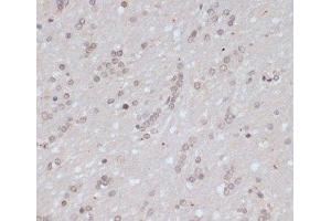 Immunohistochemistry (Paraffin-embedded Sections) (IHC (p)) image for anti-Breast Cancer 1 (BRCA1) (pSer1423) antibody (ABIN7265138)