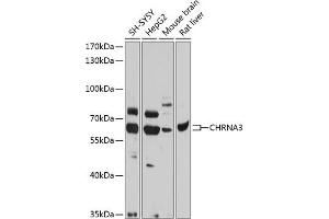 Western blot analysis of extracts of various cell lines, using CHRN antibody (ABIN6133178, ABIN6138575, ABIN6138576 and ABIN6218768) at 1:1000 dilution. (CHRNA3 抗体  (AA 32-240))