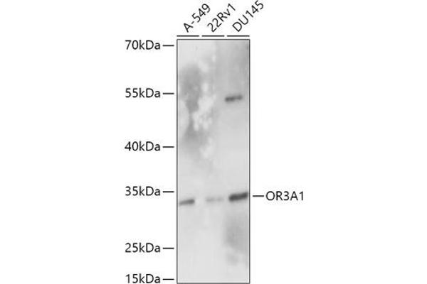 OR3A1 Antikörper  (AA 254-315)