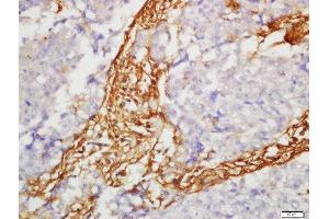 Immunohistochemistry (Paraffin-embedded Sections) (IHC (p)) image for anti-Solute Carrier Family 7 (Cationic Amino Acid Transporter, Y+ System), Member 5 (SLC7A5) (AA 101-200) antibody (ABIN1387470)