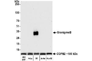 Western Blotting (WB) image for anti-Granzyme B (GZMB) (AA 19-247) antibody (ABIN7449554) (Recombinant GZMB 抗体  (AA 19-247))