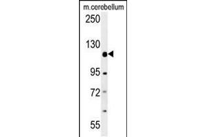 Western blot analysis in mouse cerebellum tissue lysates (15ug/lane). (Radil 抗体  (C-Term))