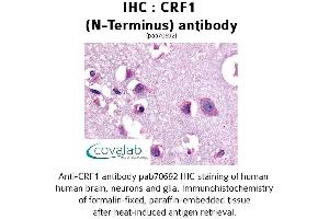 Image no. 1 for anti-Corticotropin Releasing Hormone Receptor 1 (CRHR1) (Extracellular Domain), (N-Term) antibody (ABIN1733304) (CRHR1 抗体  (Extracellular Domain, N-Term))