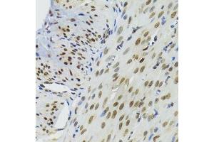 Immunohistochemistry (Paraffin-embedded Sections) (IHC (p)) image for anti-Bromodomain Adjacent To Zinc Finger Domain, 1B (BAZ1B) (AA 1-260) antibody (ABIN6137461)