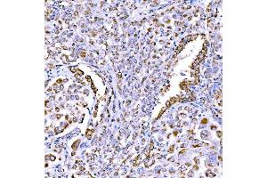 IHC analysis of SUCLG1 using anti-SUCLG1 antibody (ABIN7600906). (SUCLG1 抗体  (AA 25-346))