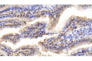 Detection of FABP2 in Bovine Small intestine Tissue using Polyclonal Antibody to Fatty Acid Binding Protein 2, Intestinal (FABP2) (FABP2 抗体  (AA 2-128))