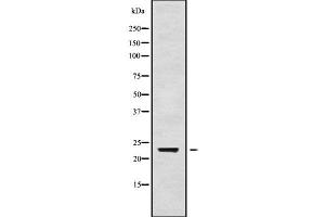 Western blot analysis of RAB24 using Jurkat whole cell lysates (RAB24 抗体  (Internal Region))