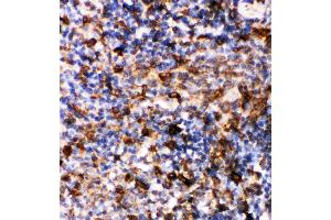 Anti-Caspase-6(P18) antibody, IHC(P): Rat Spleen Tissue