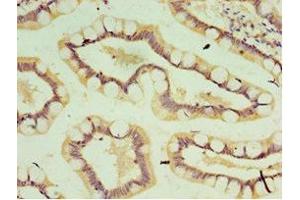 Immunohistochemistry of paraffin-embedded human small intestine tissue using ABIN7156912 at dilution of 1:100 (IL-37 抗体  (AA 1-218))