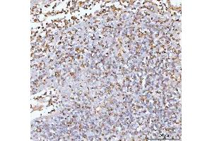 IHC analysis of IL22 using anti-IL22 antibody (ABIN5518929). (IL-22 抗体  (AA 34-179))