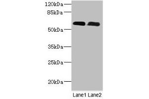 Western Blot All lanes: PNPLA1 antibody at 12 μg/mL Lane 1: Mouse spleen tissue Lane 2: Mouse skeletal muscle tissue Secondary Goat polyclonal to rabbit IgG at 1/10000 dilution Predicted band size: 58, 48, 49 kDa Observed band size: 58 kDa (PNPLA1 抗体  (AA 101-300))