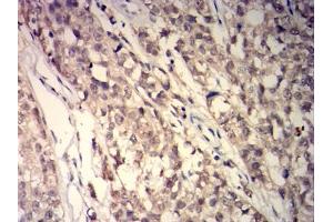 Immunohistochemistry (IHC) image for anti-Glutathione S-Transferase pi 1 (GSTP1) (AA 2-210) antibody (ABIN7193605)