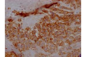 IHC image of ABIN7127316 diluted at 1:100 and staining in paraffin-embedded human placenta tissue performed on a Leica BondTM system. (Recombinant TPBG 抗体)